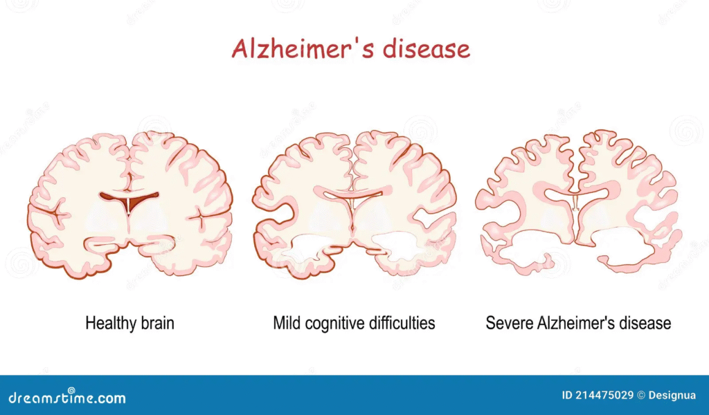 Psikologi Gagal Hindari 5 Pola Ini
